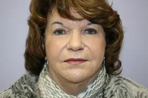Facelift Before and After Pictures Greensboro, NC