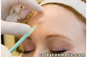 Botox Before and After Pictures Greensboro, NC